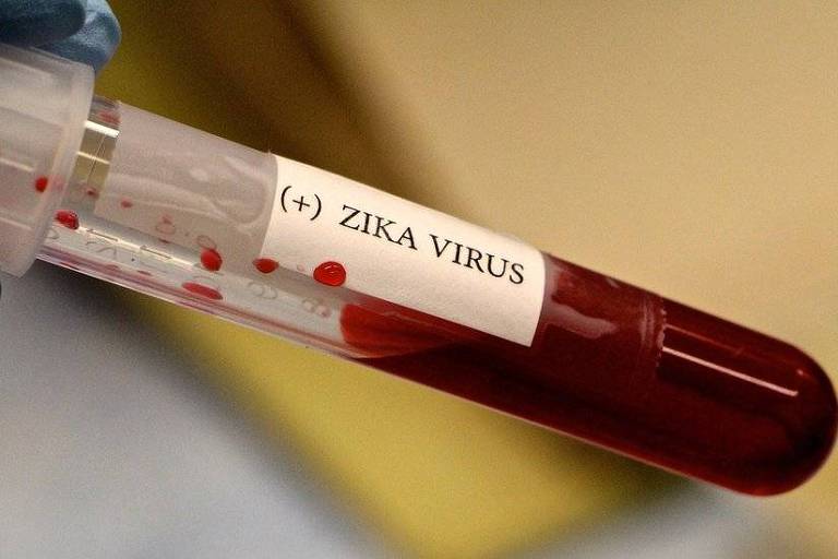 73% dos laboratórios erram diagnóstico do vírus da zika